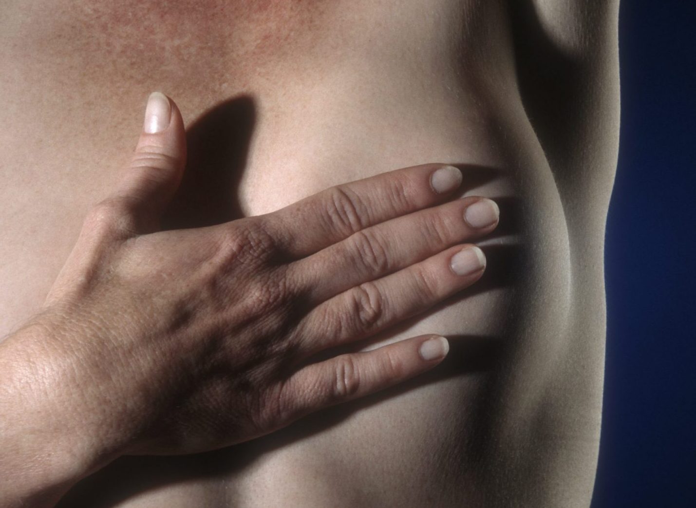 Após o câncer de mama, os tipos que mais causaram mortes foram os de traqueia, pulmão, estômago e intestino Foto: Agência Brasil